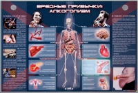 Электрифицированный стенд "Вредные привычки: алкоголизм" - «globural.ru» - Кузнецк