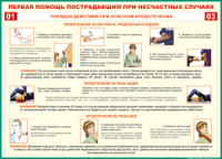 Таблица Порядок действий при опасном кровотечении 1000*1400 винил - «globural.ru» - Кузнецк