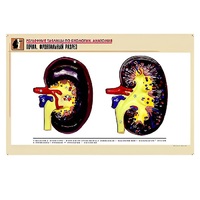 Рельефная таблица "Почка. Фронтальный разрез" (формат А1, матовое ламинир.) - «globural.ru» - Кузнецк
